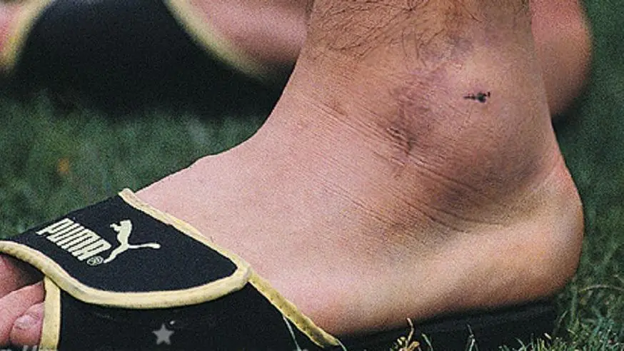 El tobillo herido de Maradona